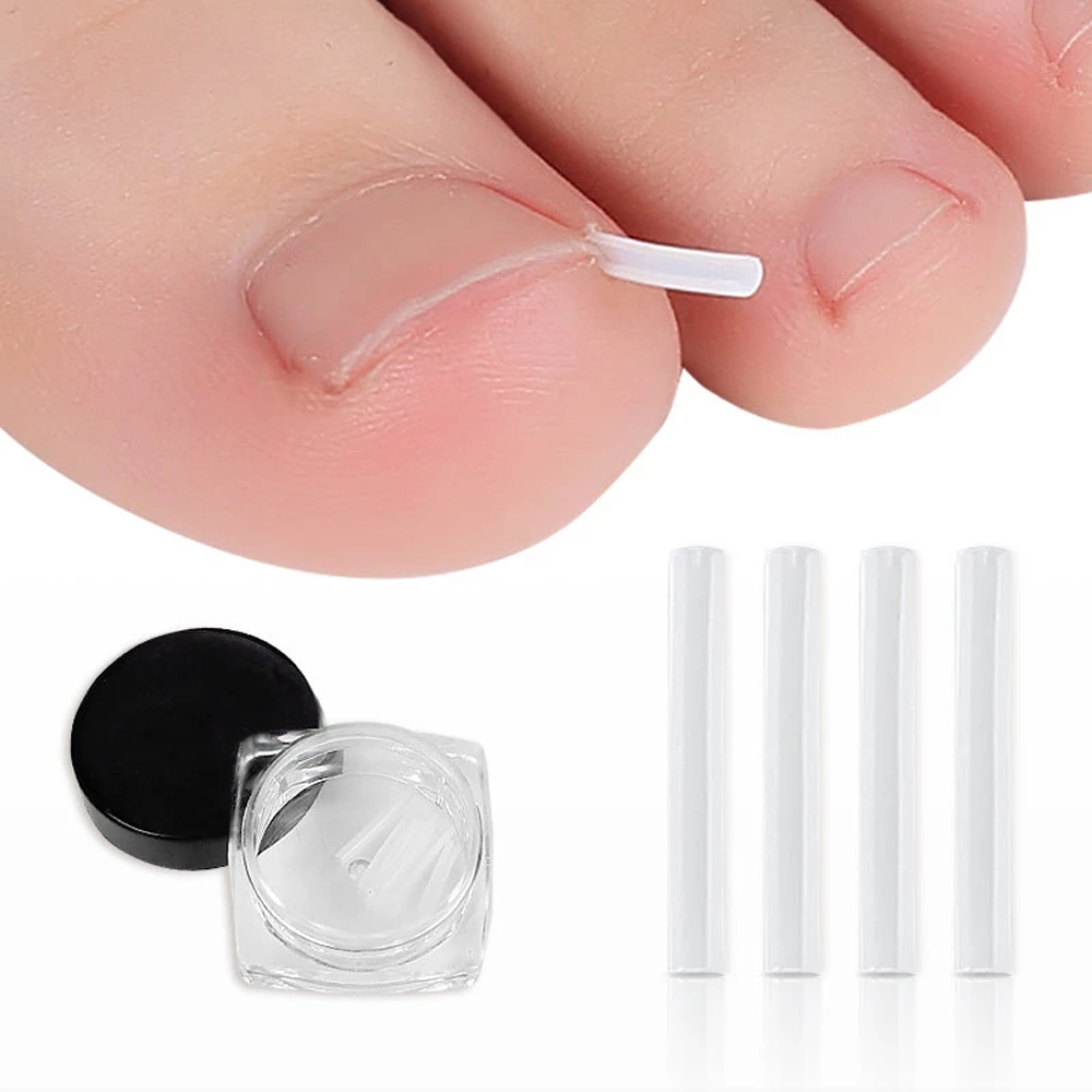 Miếng dán chỉnh hình móng chân mọc ngược WAF2125 - INTL