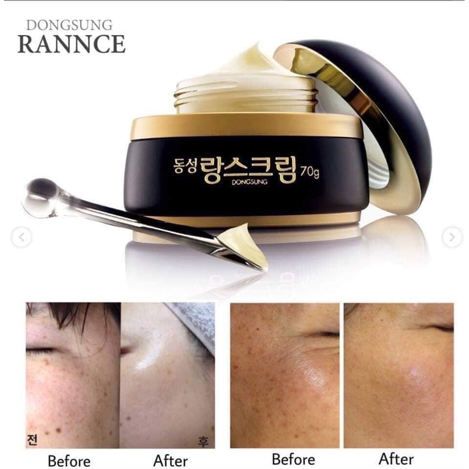 Kem Nám Dongsung Rannce Cream ( TẶNG SỮA RỬA MẶT HÀN QUỐC+ 2 MASK ).