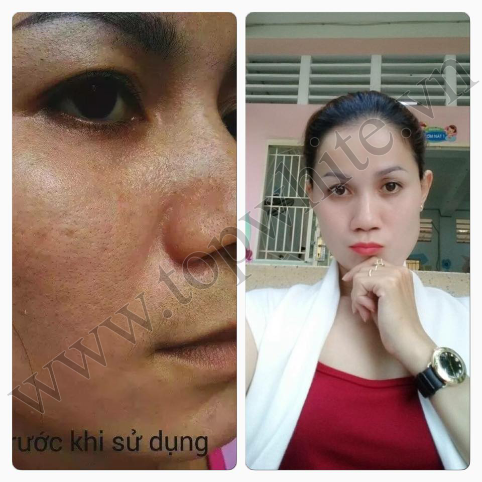 Kem Chống Nắng Top White D3 SPF 50+ PA++++