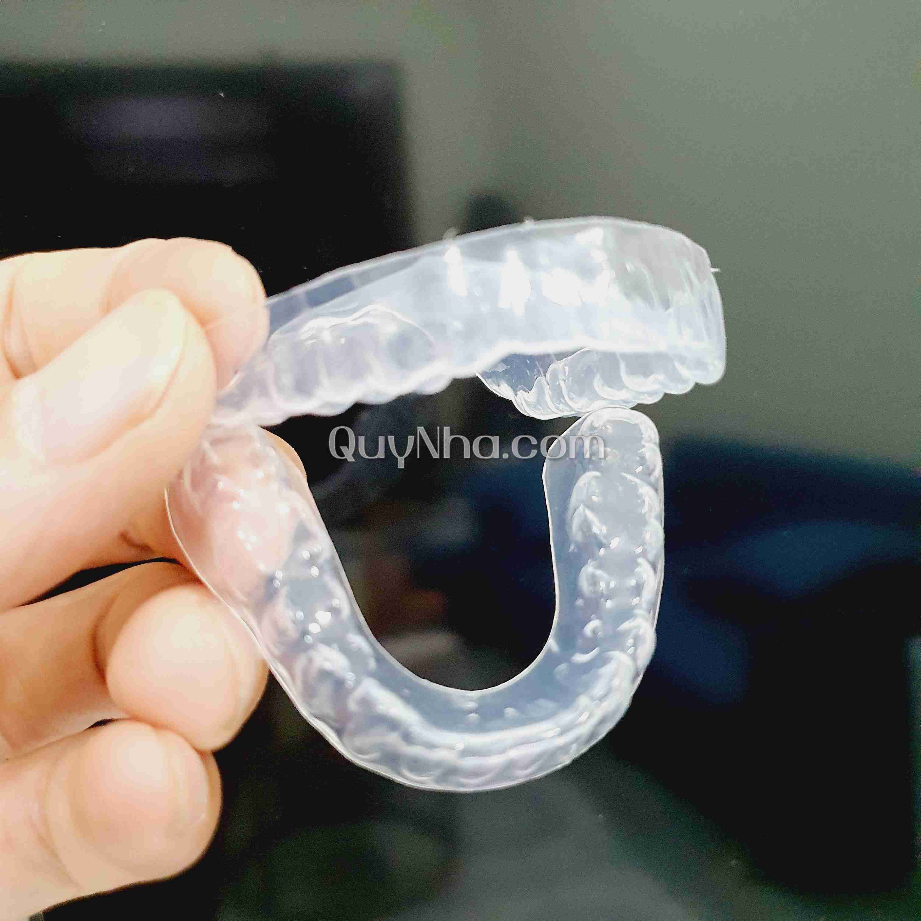 Máng tẩy trắng răng tại nhà