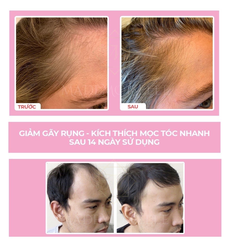 SERUM TINH CHẤT BƯỞI PLUS