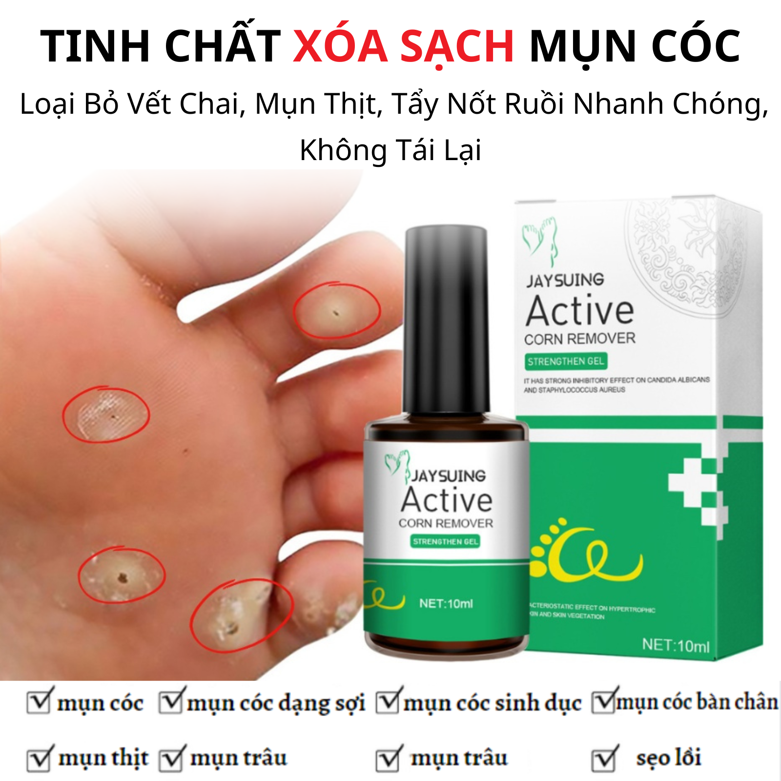 Tinh Chất Xóa Sạch Mụn Cóc, Loại Bỏ Vết Chai, Mụn Thịt, Tẩy Nốt Ruồi Nhanh Chóng, Không Tái Lại