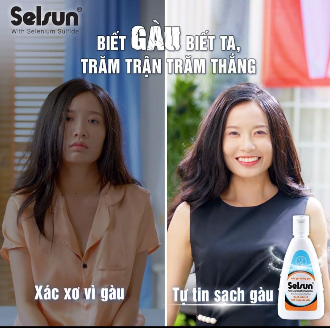 Dầu gội chống gàu Selsun 50ml/100ml