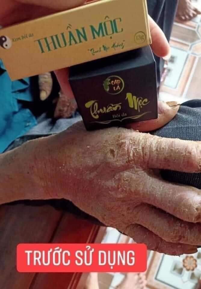 Combo thuần mộc và cao lá thuần mộc