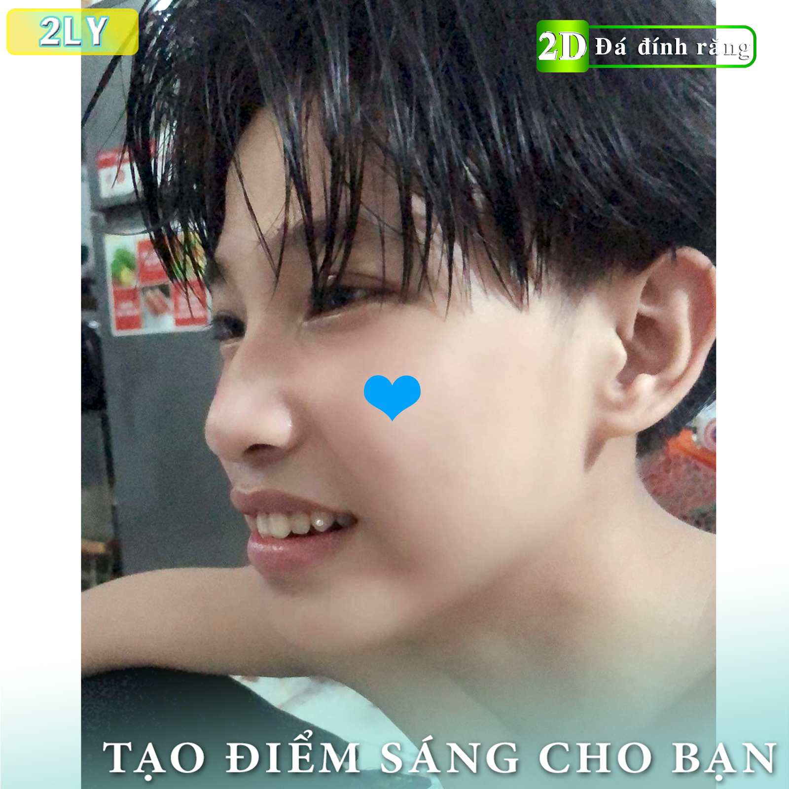 Đá dán răng loại nhỏ (5 viên 2LY + keo dán + bút gắn)