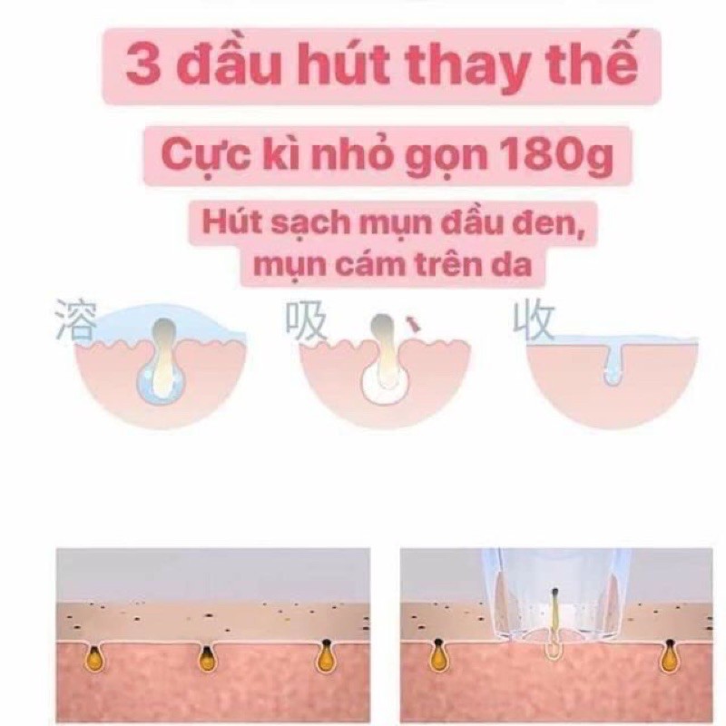 Máy Hút Mụn Siêu Sạch Black Head Giảm Mụn Đầu Đen