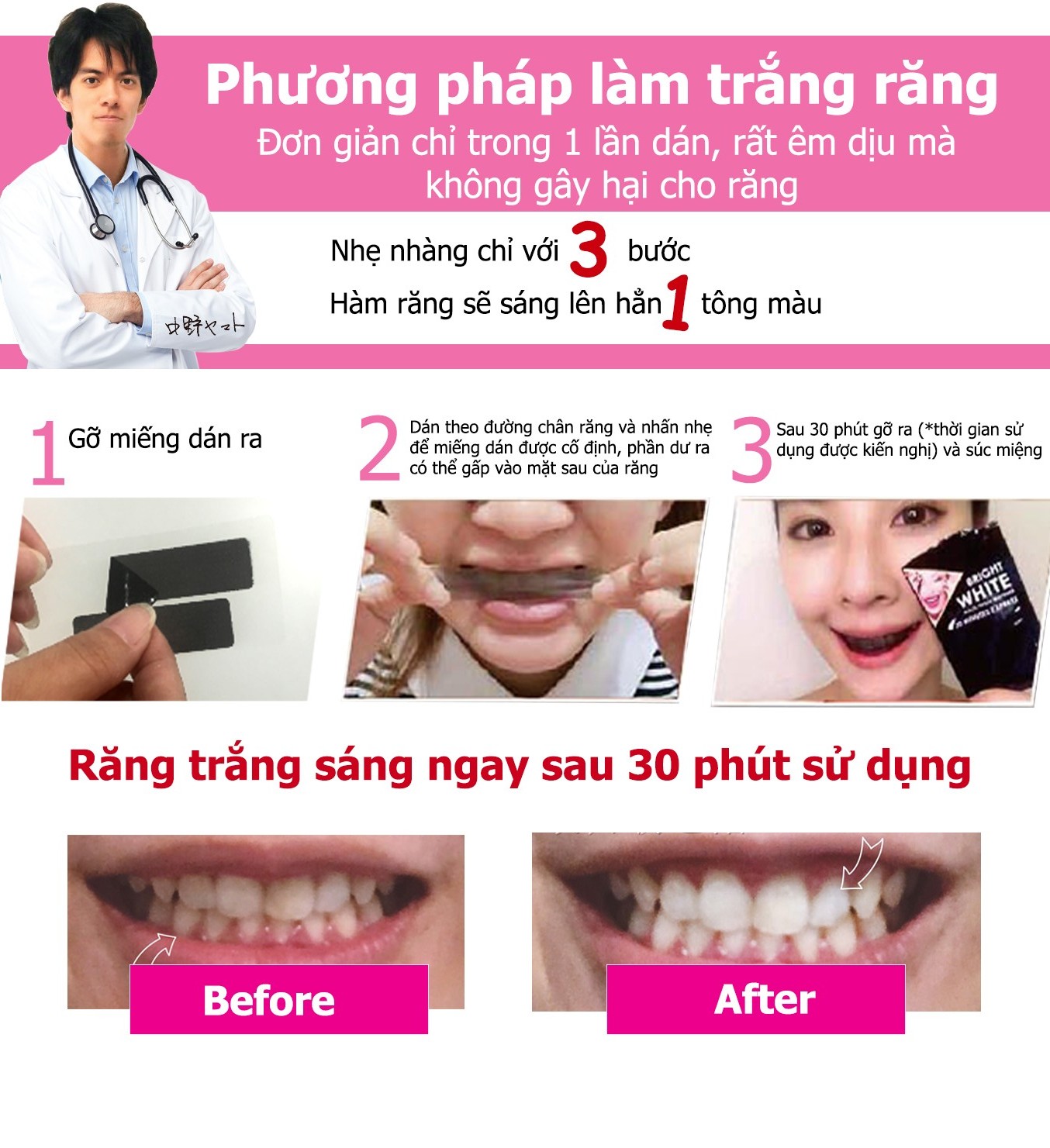 Anriea miếng dán trắng răng (miếng lẻ)