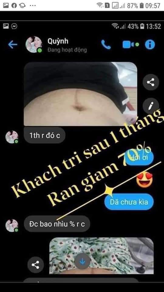 Kem xóa\làm mờ rạn da\thâm da Multi 16