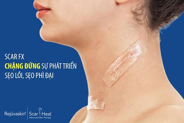 Miếng Dán Mờ Sẹo Lồi Sẹo Phẫu Thuật Scar Fx 3x10cm