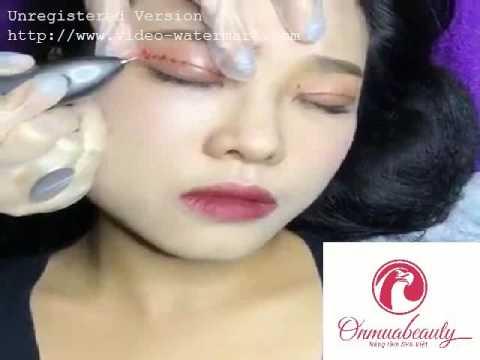 Máy Nhấn Mí Plasma Hàn Quốc