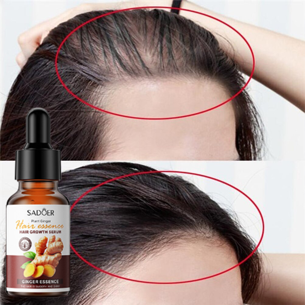Thuốc mọc tóc serum kích mọc tóc chống rụng tóc kích mọc tóc chăm sóc tóc 30ml  kích thích mọc tóc nhanh làm dày