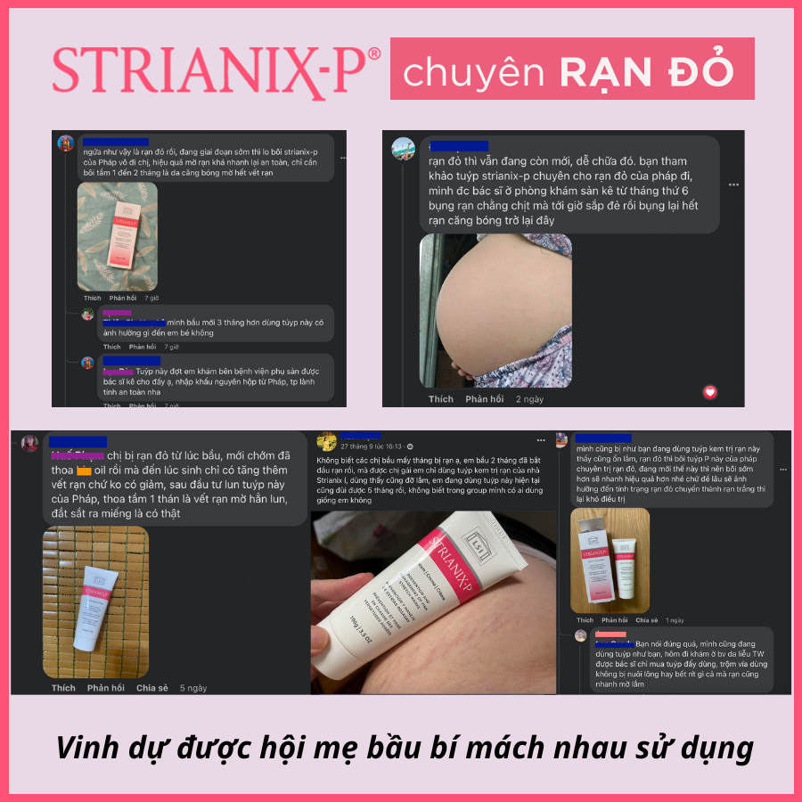Set 2 tuýp 100g kem rạn STRIANIX-P phòng và làm mờ RẠN ĐỎ