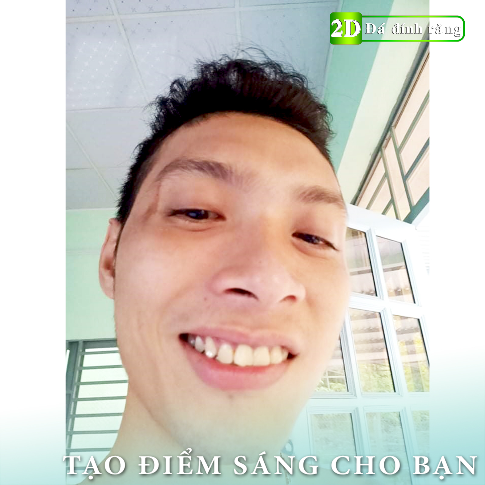 [HCM]Combo đá đính răng chân bằng 2.5ly (loại tự dán) + bột trắng răng thơm mát Eucryl