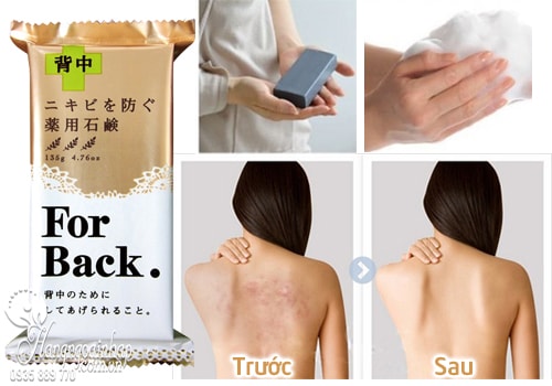 Xà Phòng Ngừa Mụn Lưng For Back Nhật Bản.