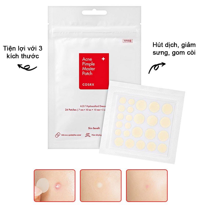 Miếng dán mụn Cosrx Acne Pimple Master Patch 24 miếng và Cosrx The Clear Pit Master Patch 18 miếng.