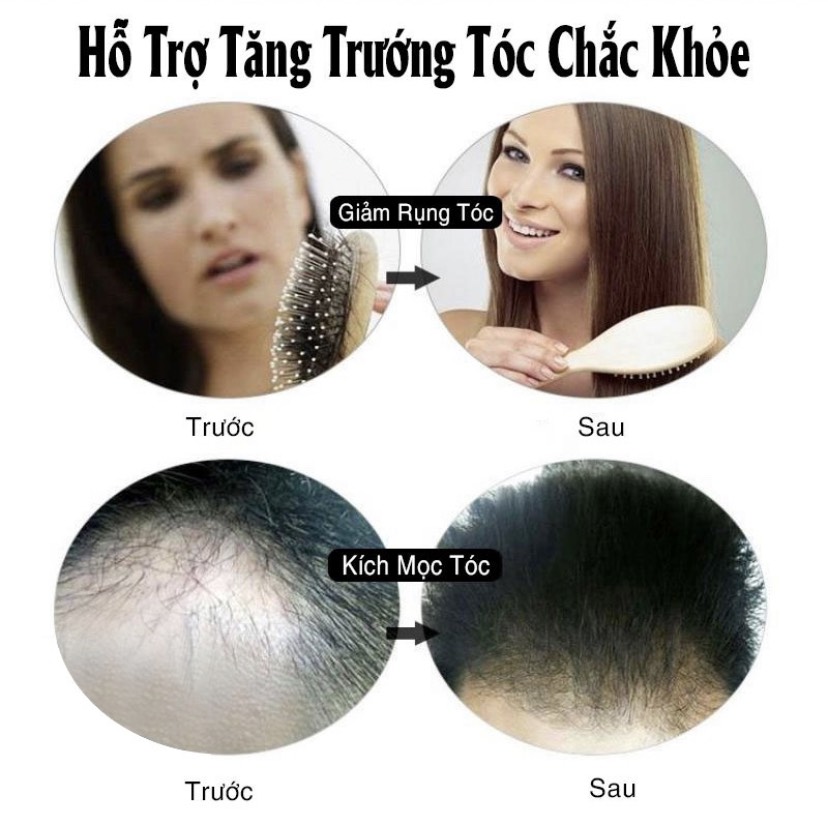 [HCM]Tinh chất ngăn ngừa rụng tóc kích mọc tóc nhanh chóng