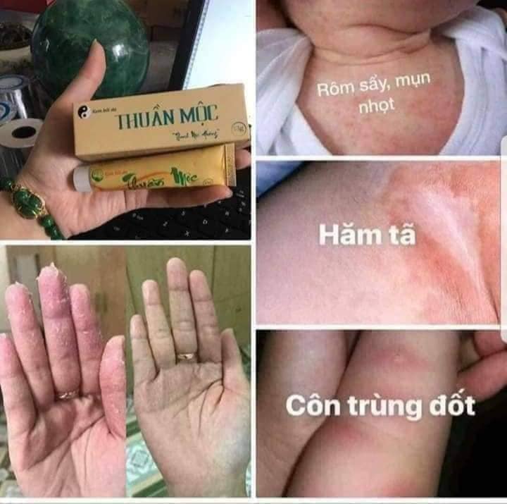 Kem Bôi Da Thuần Mộc Thanh Mộc Hương 16g - Làm Mềm Da Dịu Mát Da
