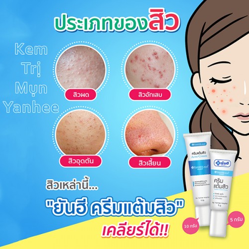 Kem thoa mụn yanhee acne cream thái lan 10g