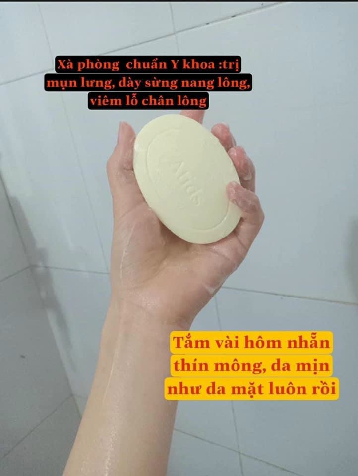 Xà phòng tắm Atids