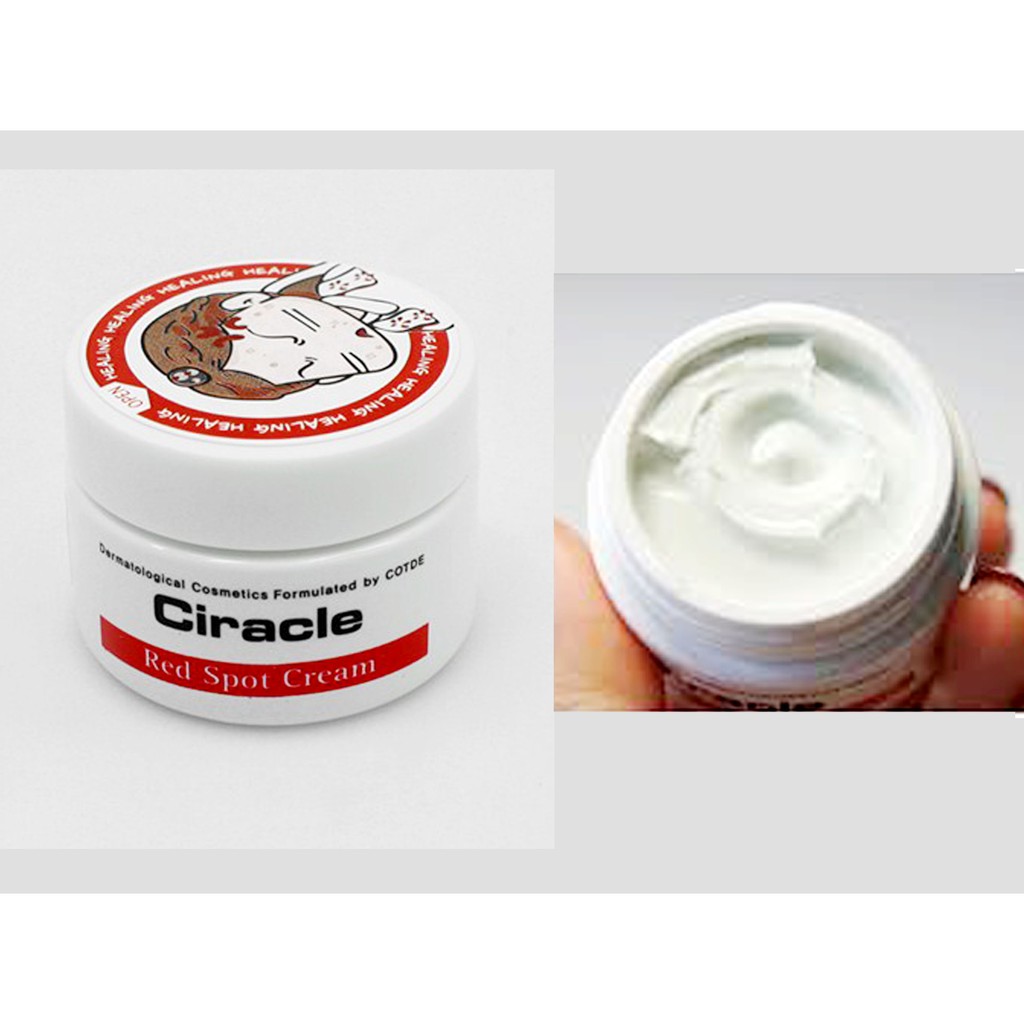 [Hot] Kem Trị Mụn Sưng Đỏ Ciracle Red Spot 30g