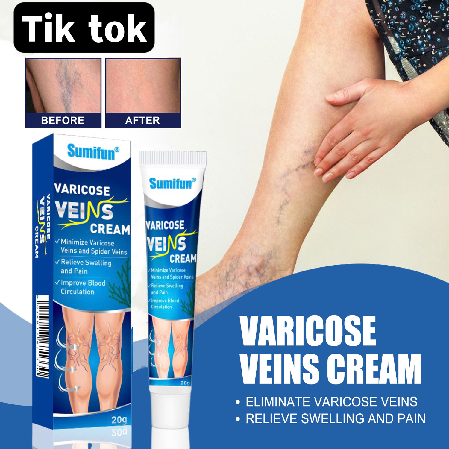 100 AUTHENTIC VARICOSE VEINS CREAM Kem phục hồi giãn tĩnh mạch kem