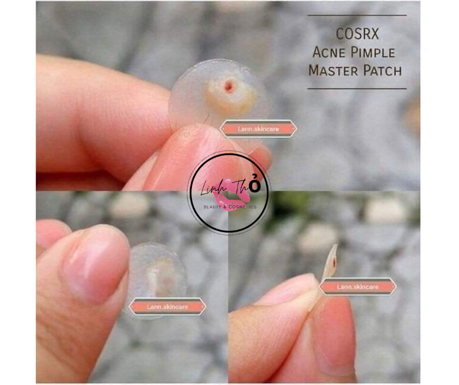 Dán Mụn COSRX Acne Pimple Master Patch 24 miếng/ gói