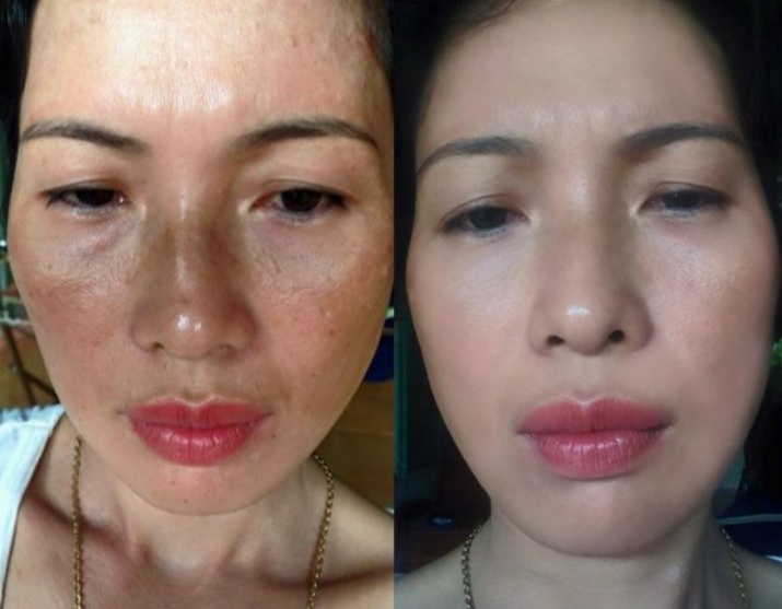 [HCM]Feel Thay da Niraci của Hàn Quốc  tái tạo da mới căng mịn