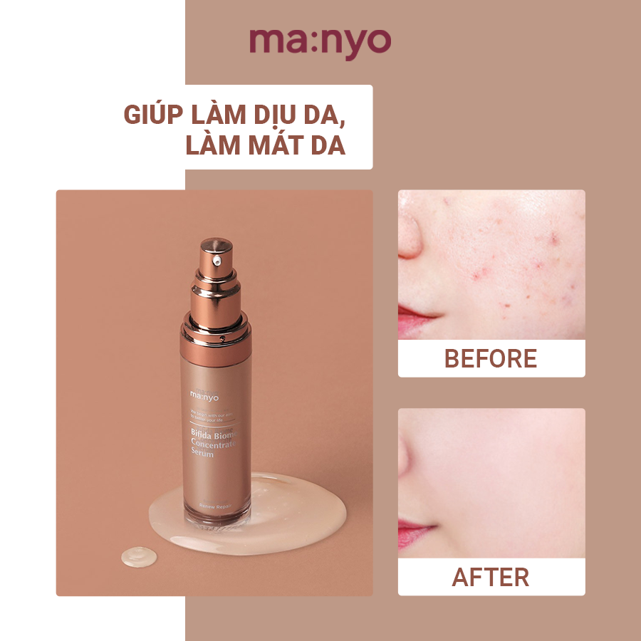 Tinh Chất Trẻ Hoá Da Manyo BIFIDA BIOME CONCENTRATE SERUM 35ml