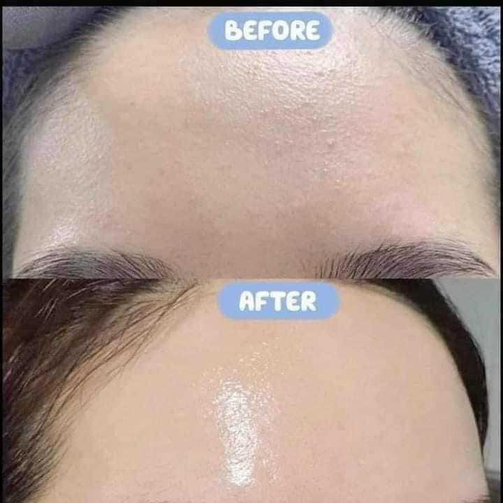 SERUM HA + B5 GC NATURE (Hàn Quốc 100ml)