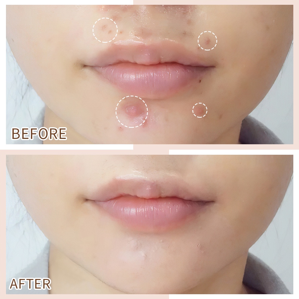 Bút Che Khuyết Điểm GECOMO Chống Thấm Nước