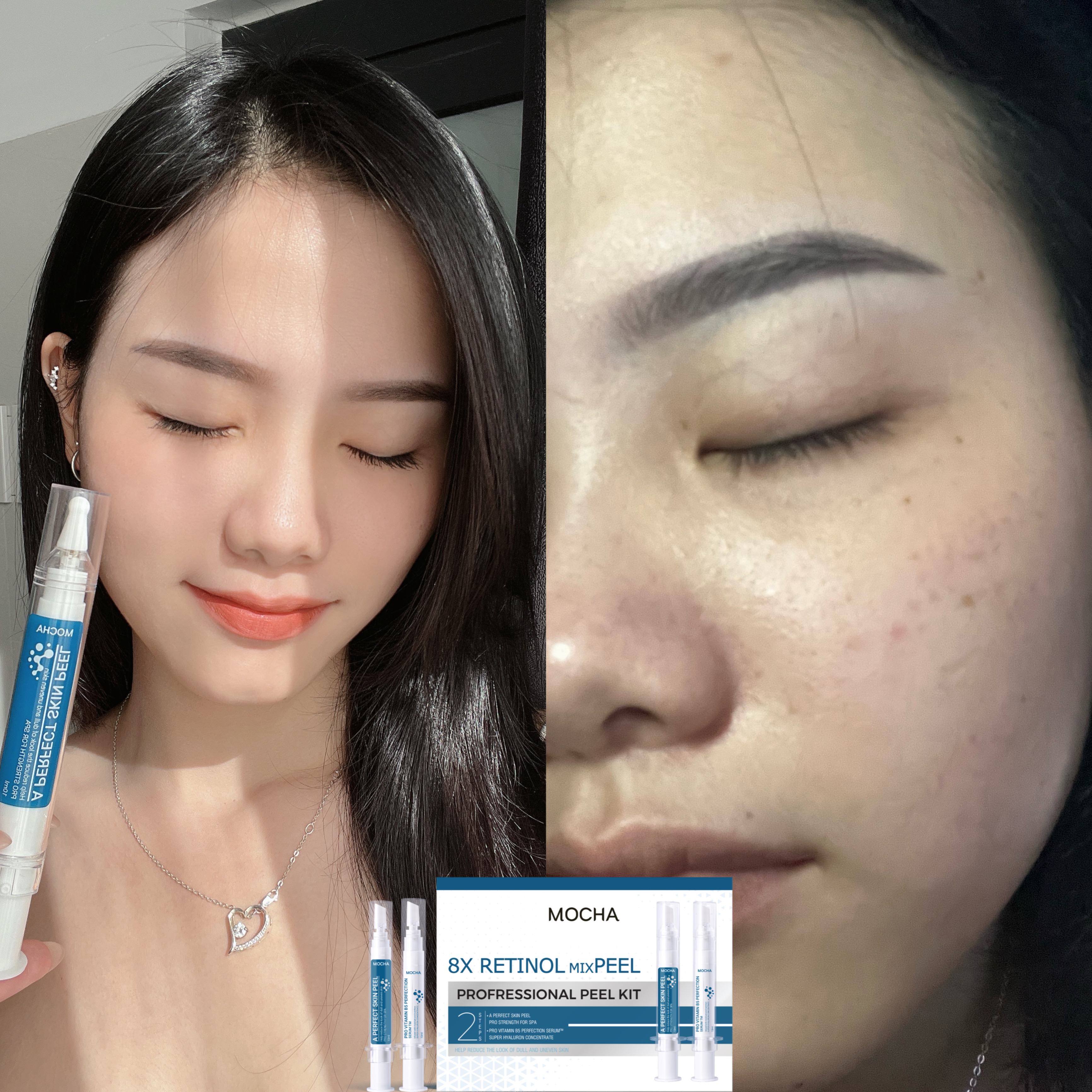 Peel da Mocha Retinol MUA 1 được 5 sản phẩm