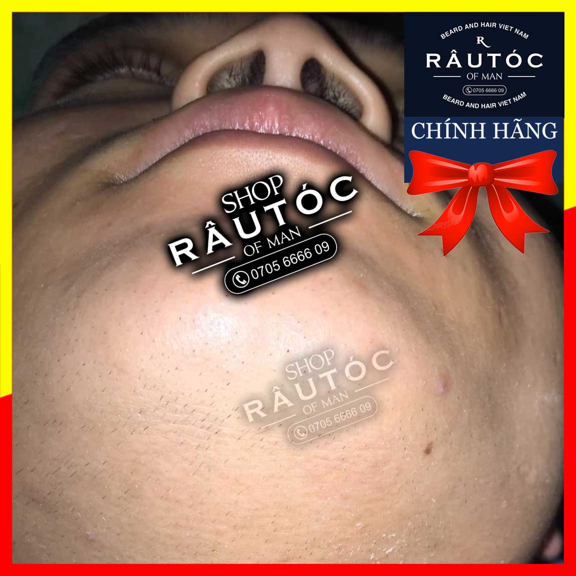 Bột Lclt , Retinol hổ trợ mọc râu nhanh