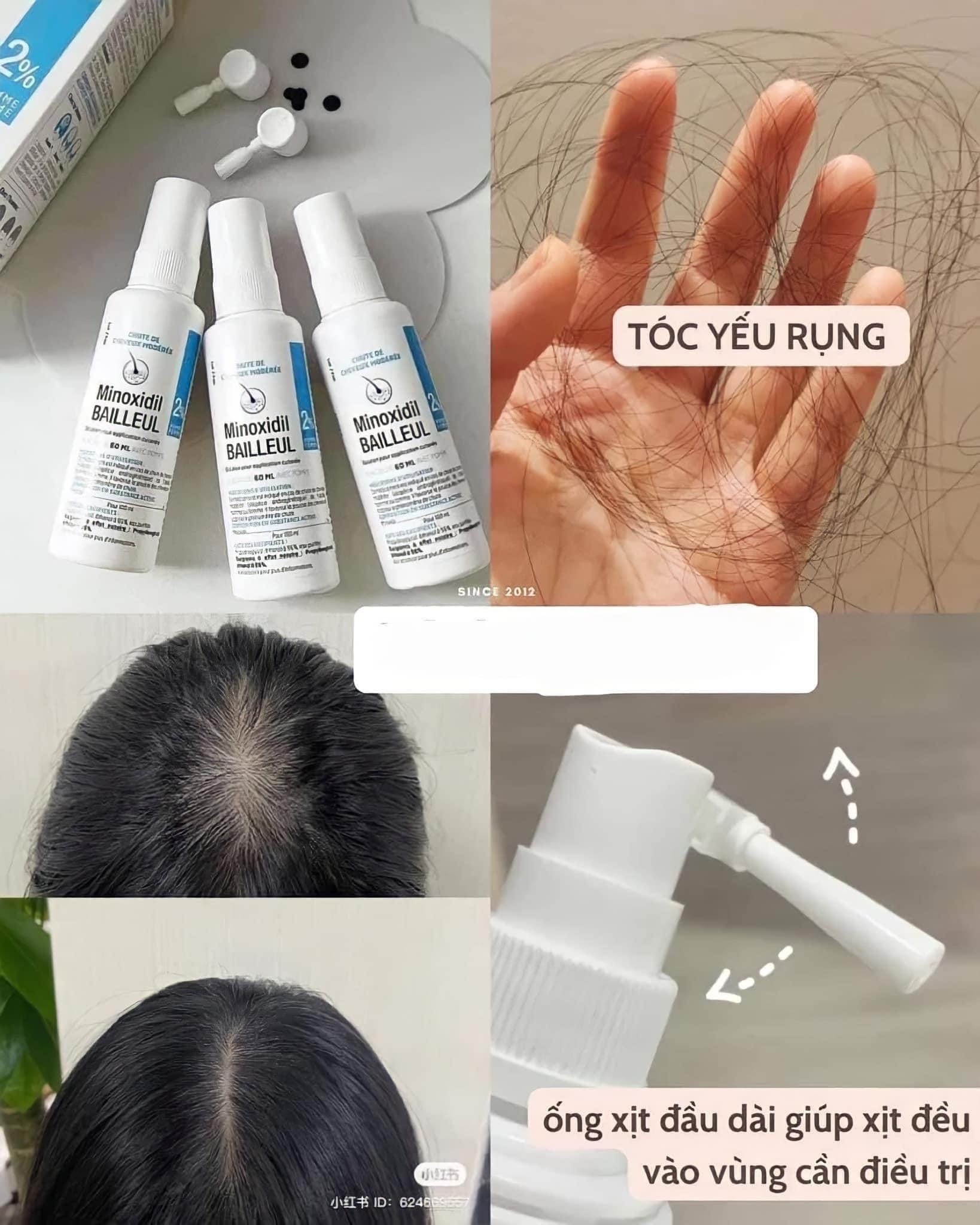(Nhập khẩu trực tiếp Pháp - Date 2026) Xịt mọc tóc Minoxidil Bailleul 2% NGĂN RỤNG TÓC, KÍCH THÍCH MỌC TÓC [Hộp 3 lọ x 60ml]