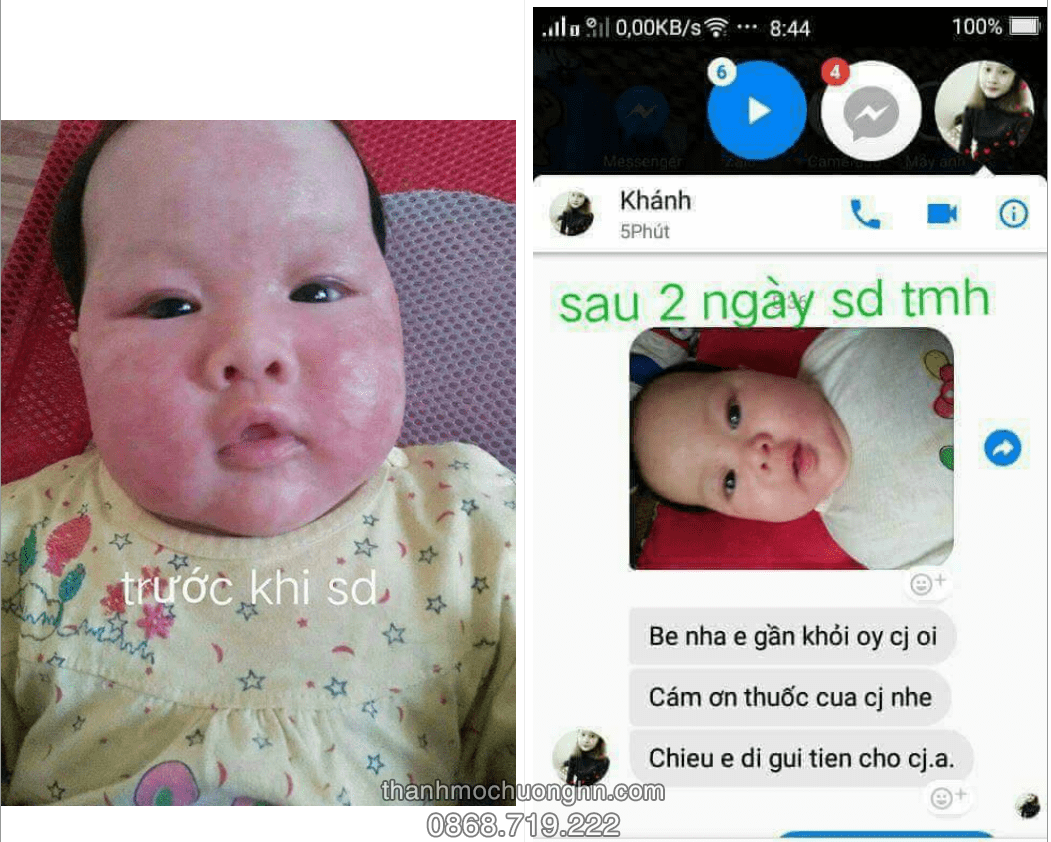 [HCM][CHÍNH HÃNG] Kem Bôi Da Thuần Mộc