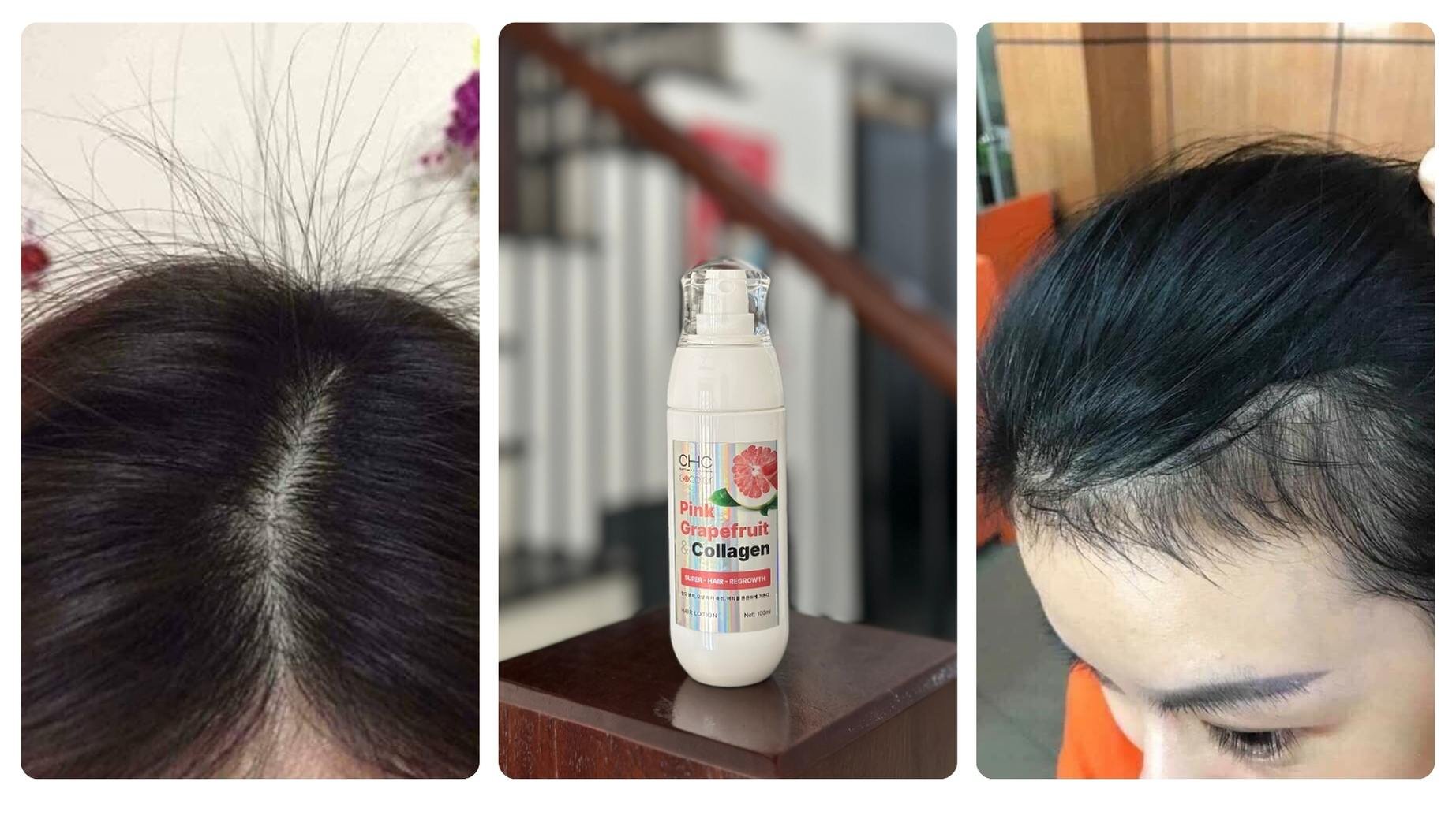 Xịt bưởi Collagen CHC kích mọc tóc