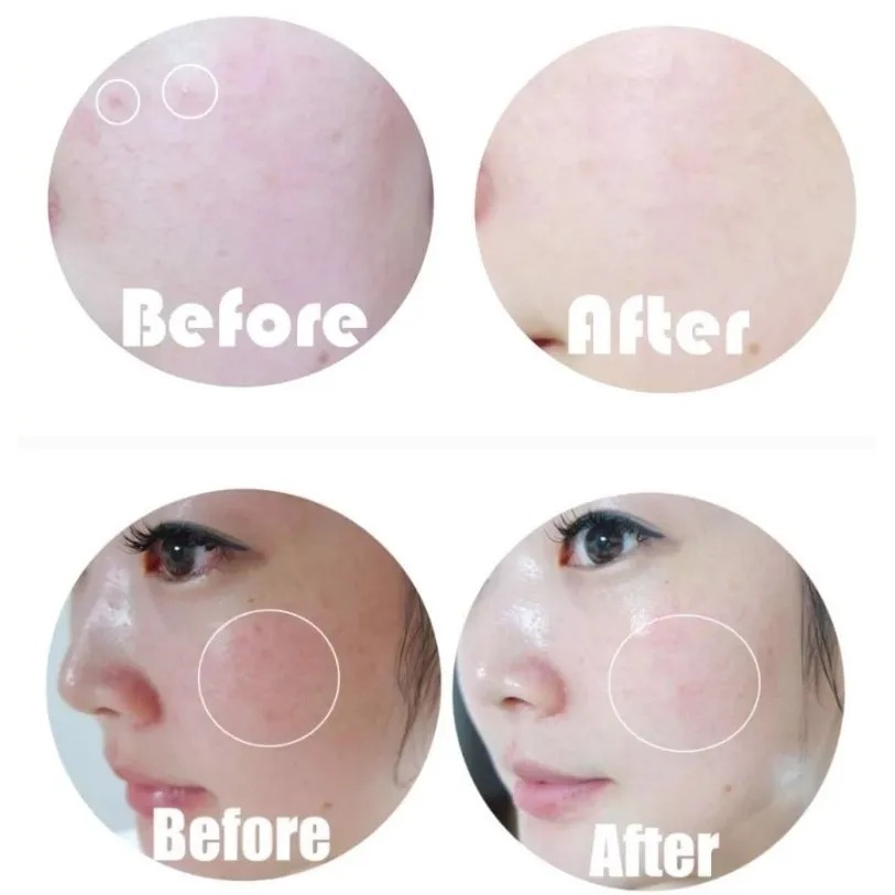 [Chính hãng] Tinh Chất Dưỡng Trắng, Làm Sáng Da Tiam Vita B3 Source 40ml