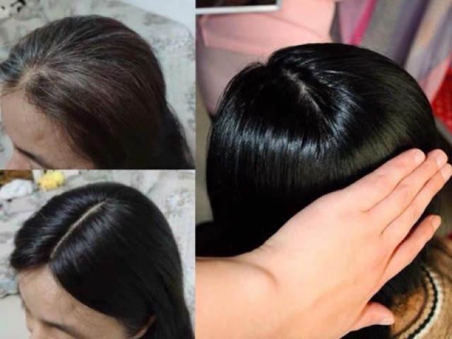 Che Hói Nữ-Tóc Che Hói Nữ Mái Dài - 35Cm