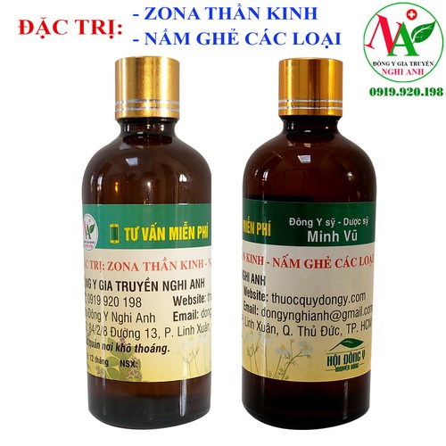 Zona thần kinh bằng thảo mộc - 01 chai