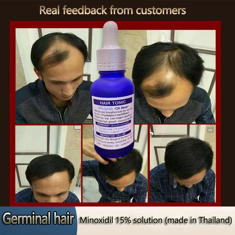 Minoxidil 15% Sản xuất tại Thái Lan đích thực