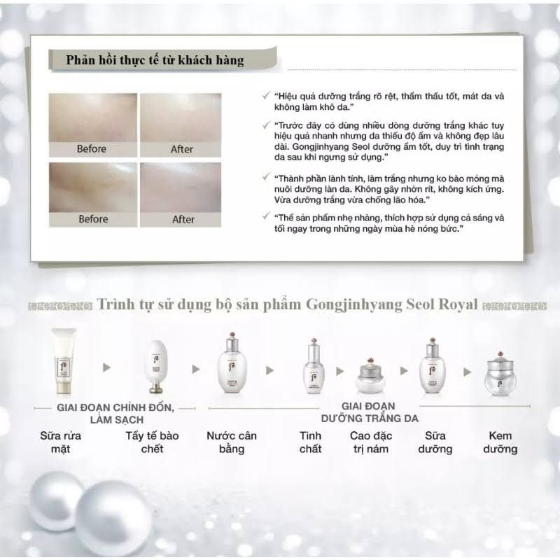 Set 10 Vỉ Cao nám whoo radiant white ultimate corrector