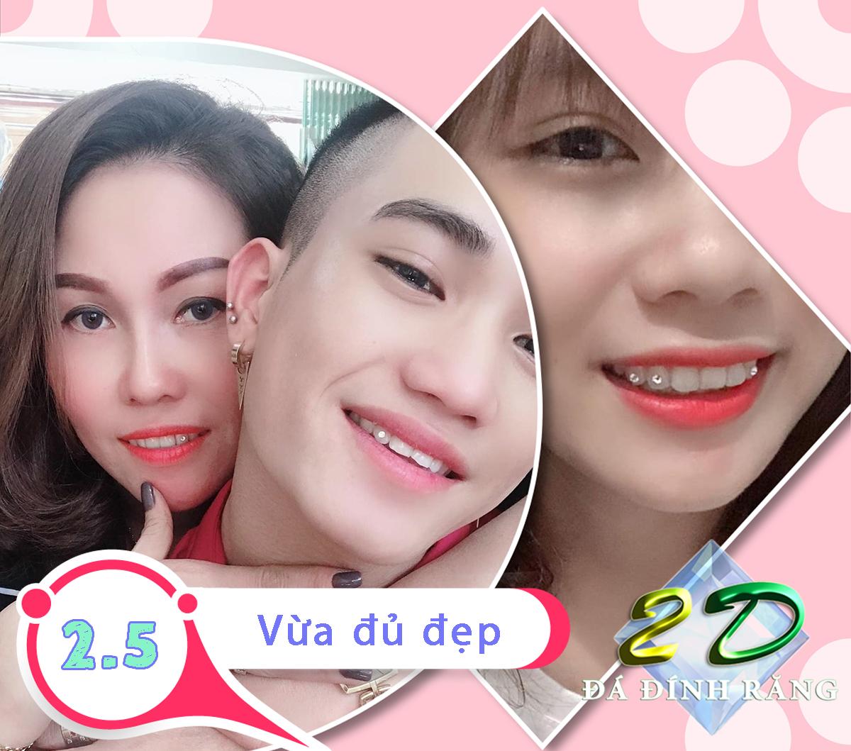 [HCM]Mua 1 tặng 1-Đá đính răng Thụy Sĩ 2.5LY (loại vừa đủ đẹp)