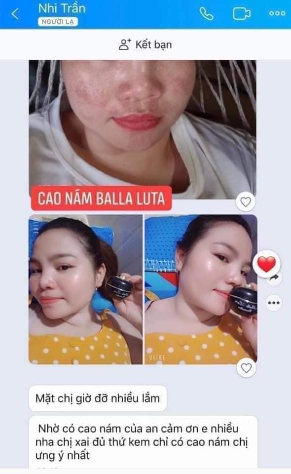 Cao nám bala luta hộp 10g