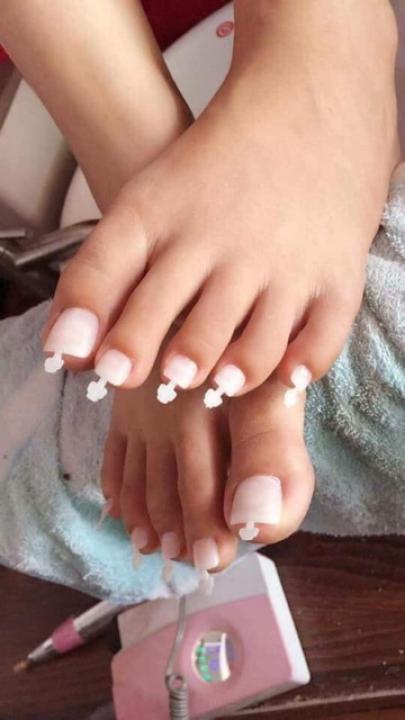 Móng úp chân HSM Phụ kiện Nail