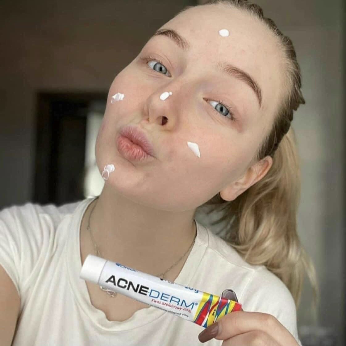 Kem giảm thâm và giảm mụn Acnederm 20gr