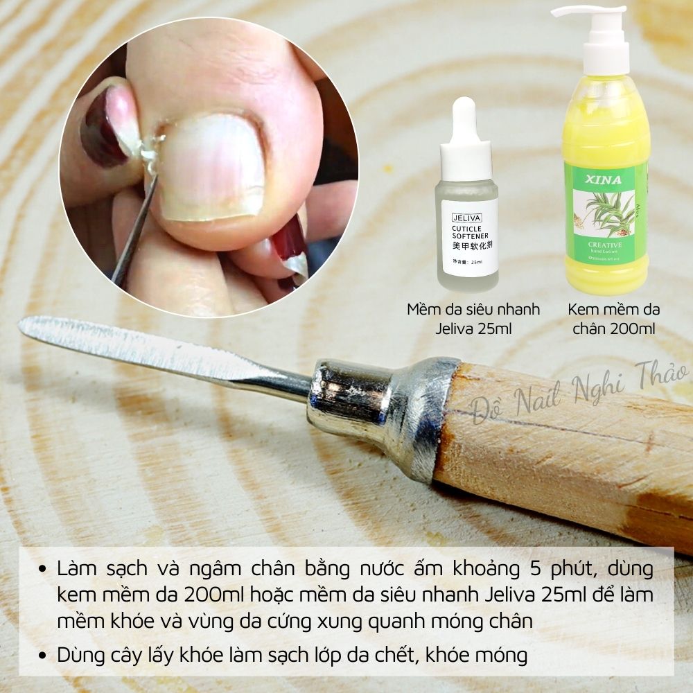 Cây lấy khóe móng chân cán gỗ