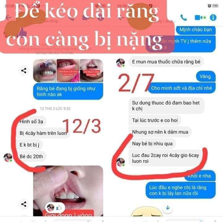 Sâu răng Nhật Dương