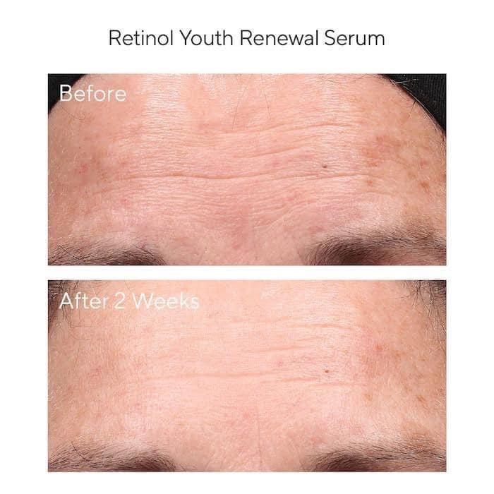 Retinol mini 5ml