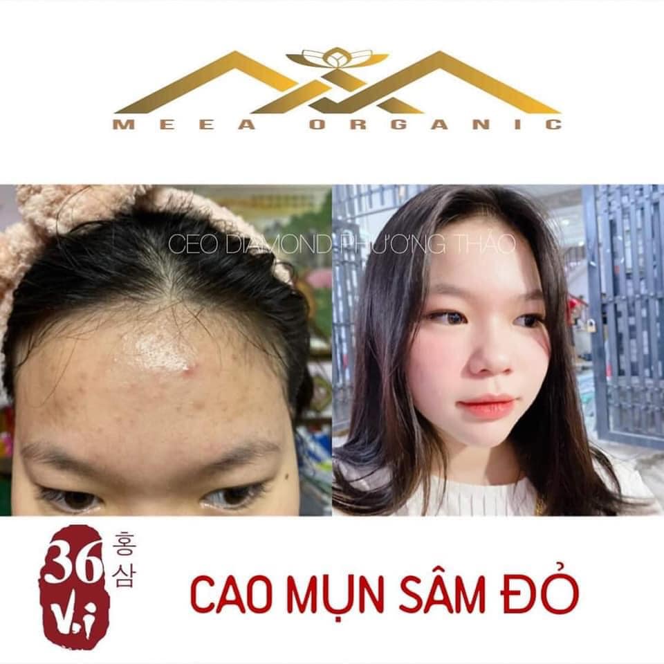 [HCM] (Mới) Cao Mụn Sâm Đỏ 36 Vị (Hộp 15g) Date Mới - Meea Organic