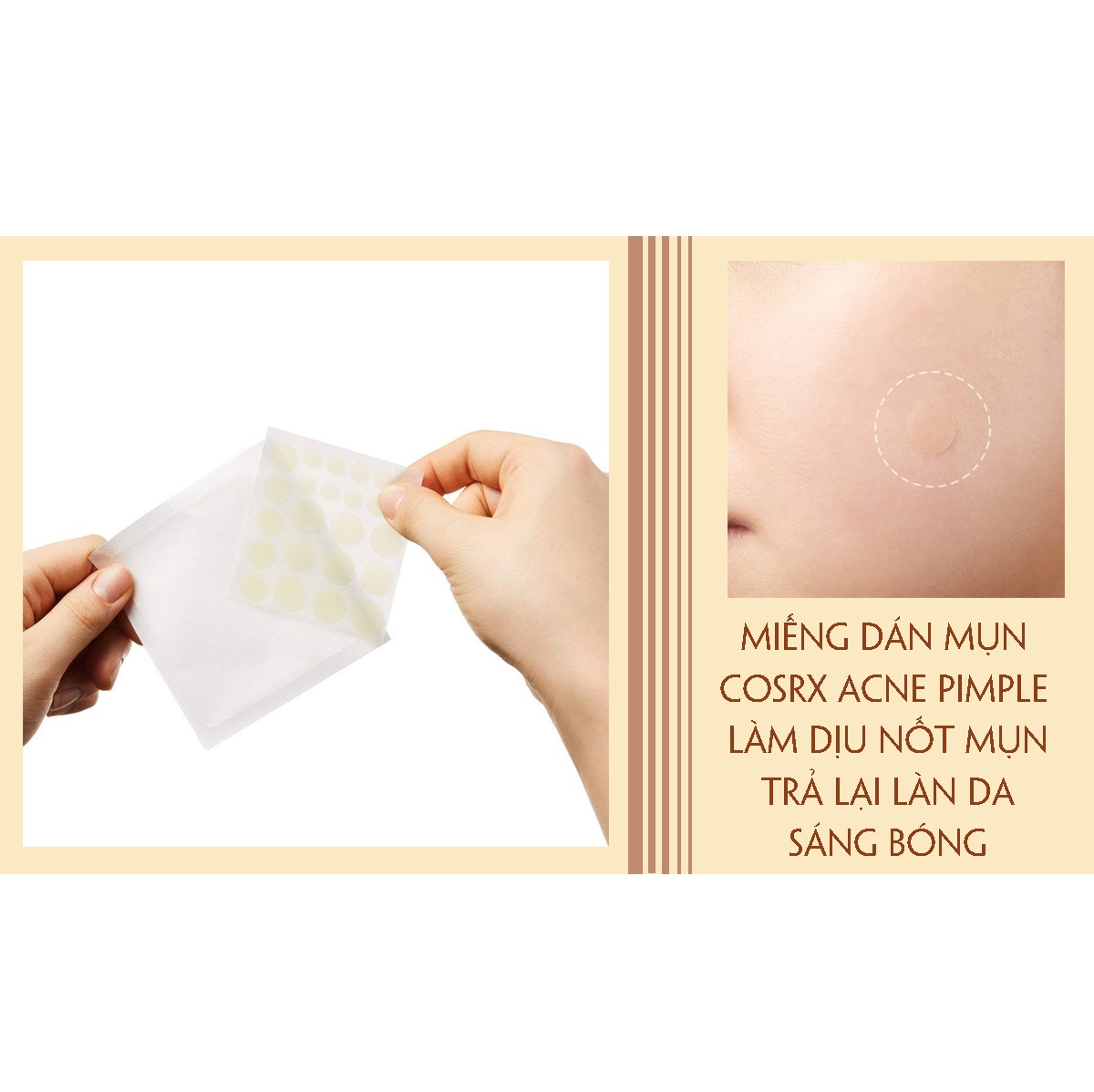 Miếng dán mụn Cosrx Acne Pimple Master Patch Đỏ, Đen