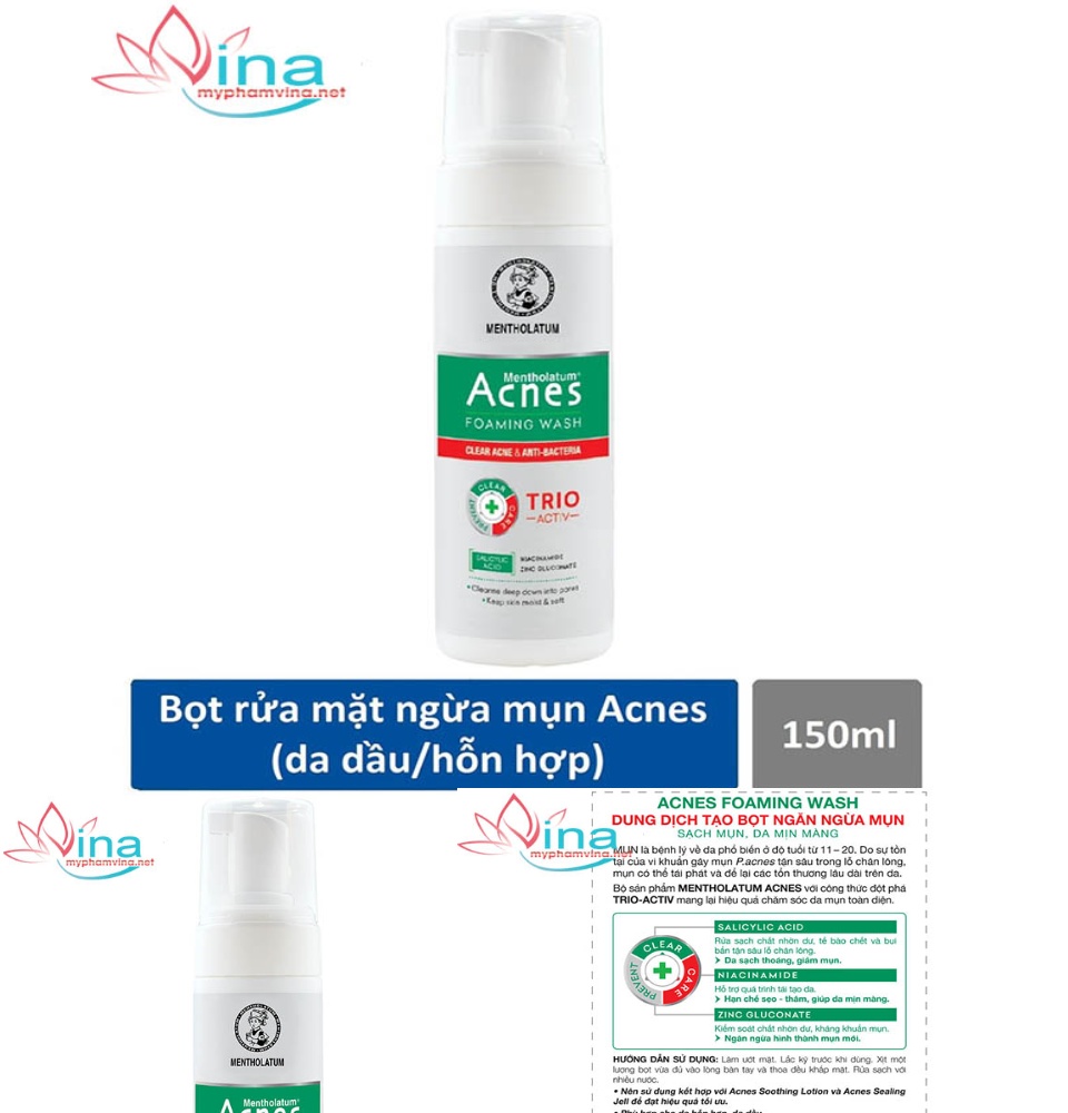 [HCM]Sữa Rửa Mặt Tạo Bọt Ngăn Ngừa Mụn Acnes 150ml